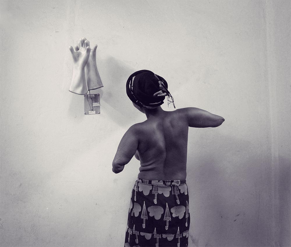 How a Mother With Amputated Arms Became an Angel in Her Daughter’s Eyes