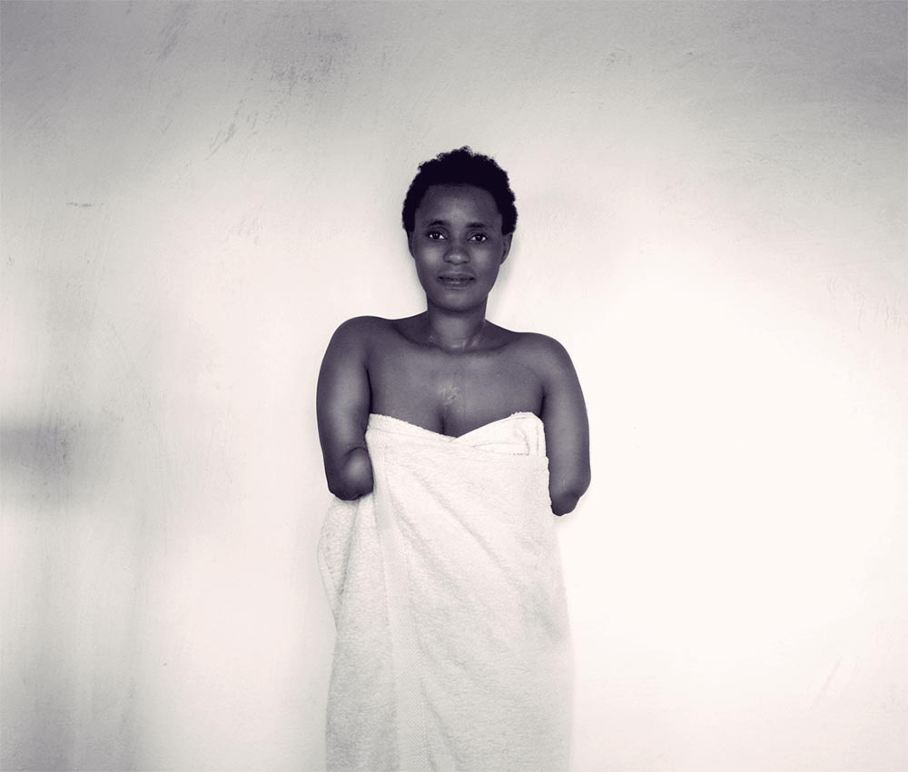 How a Mother With Amputated Arms Became an Angel in Her Daughter’s Eyes